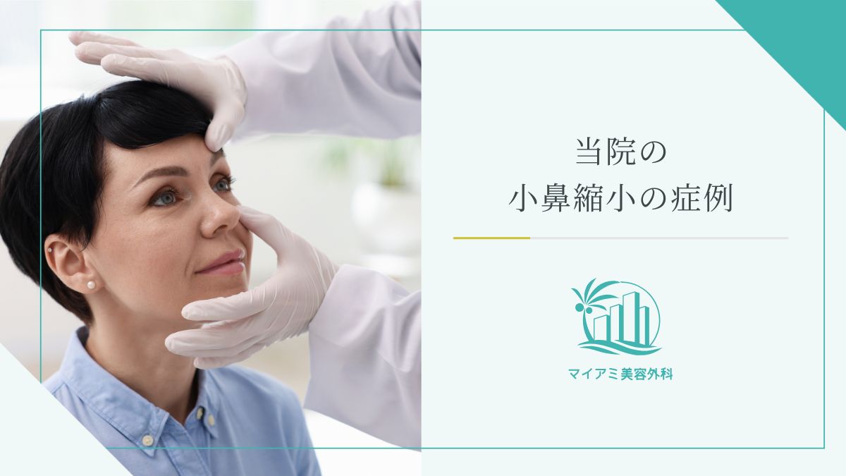 当院の小鼻縮小の症例