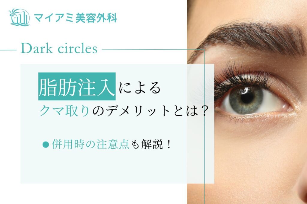 脂肪注入によるクマ取りのデメリットとは?併用時の注意点も解説!