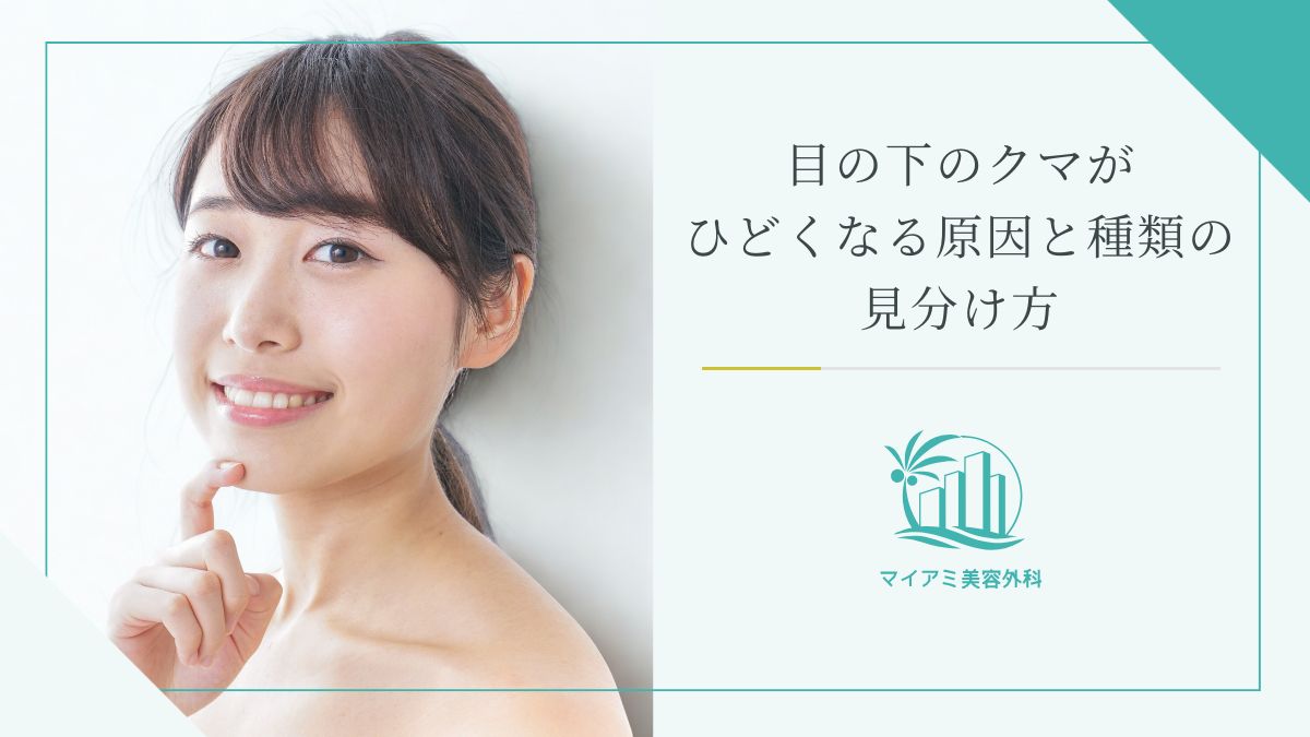 目の下のクマがひどくなる4つの原因と種類の見分け方