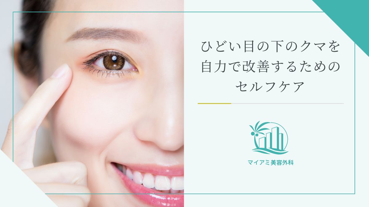 ひどい目の下のクマを自力で改善するためのセルフケア