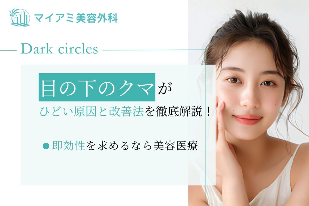 目の下のクマがひどい原因と改善法を徹底解説！即効性を求めるなら美容整形の検討も