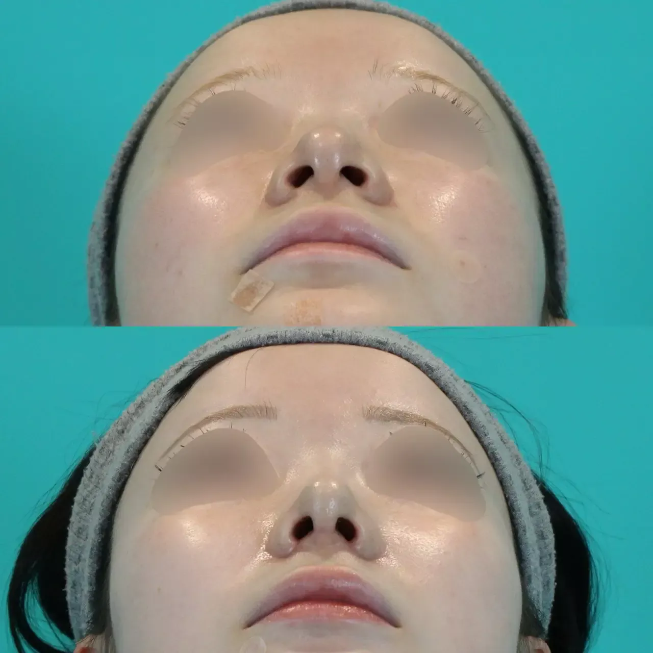 施術前後イメージ