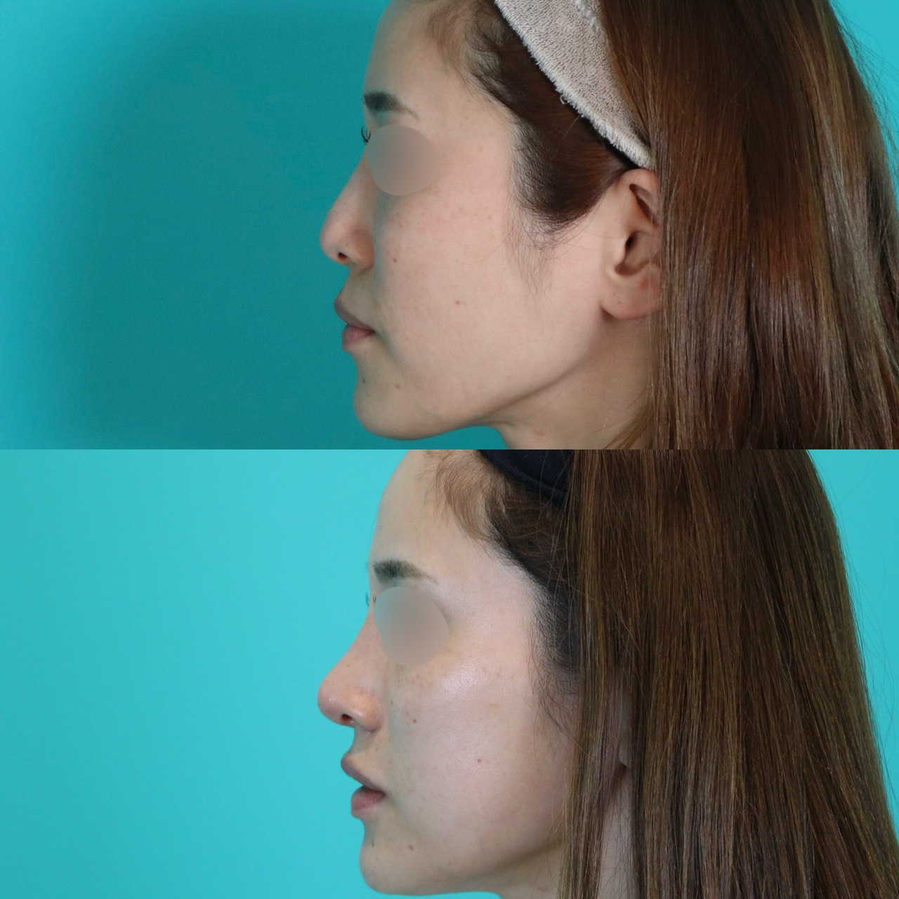 施術前後イメージ