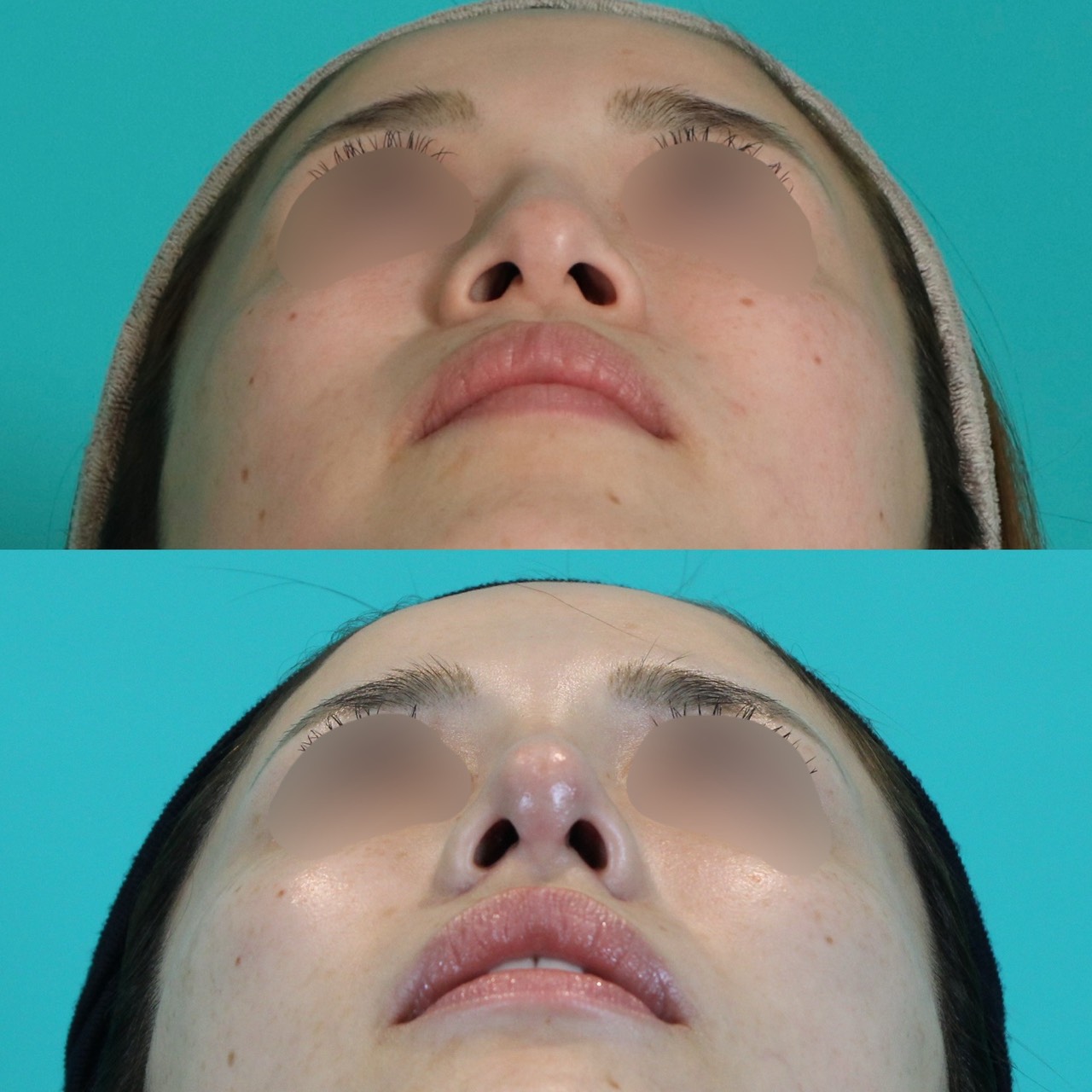 施術前後イメージ