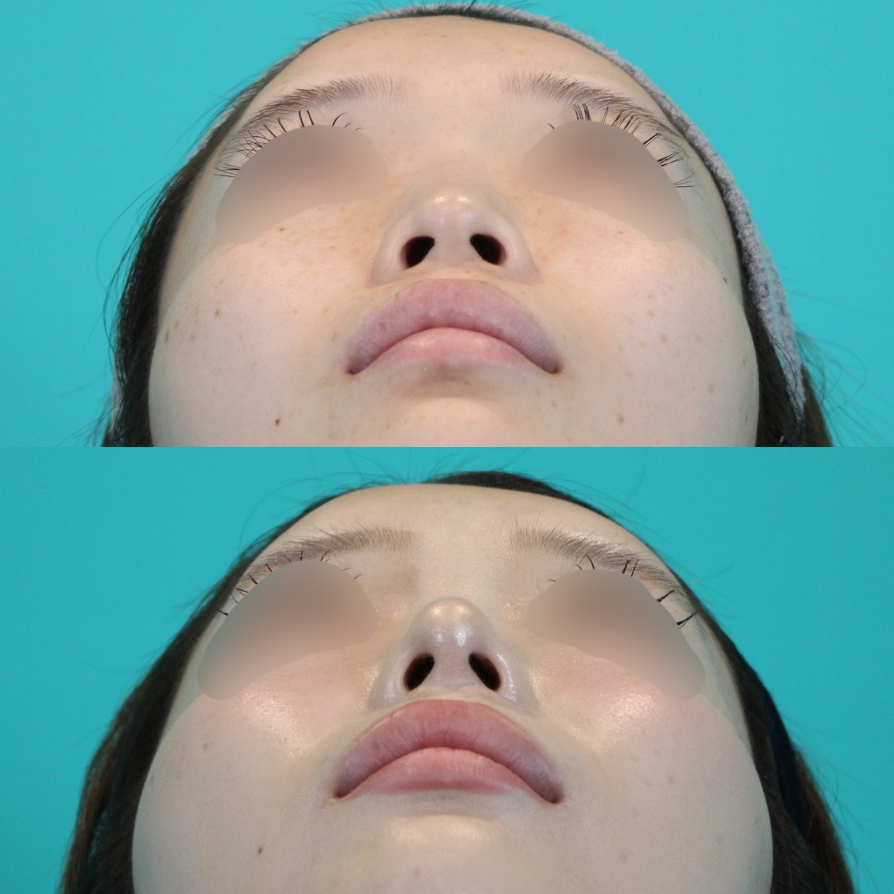 施術前後イメージ