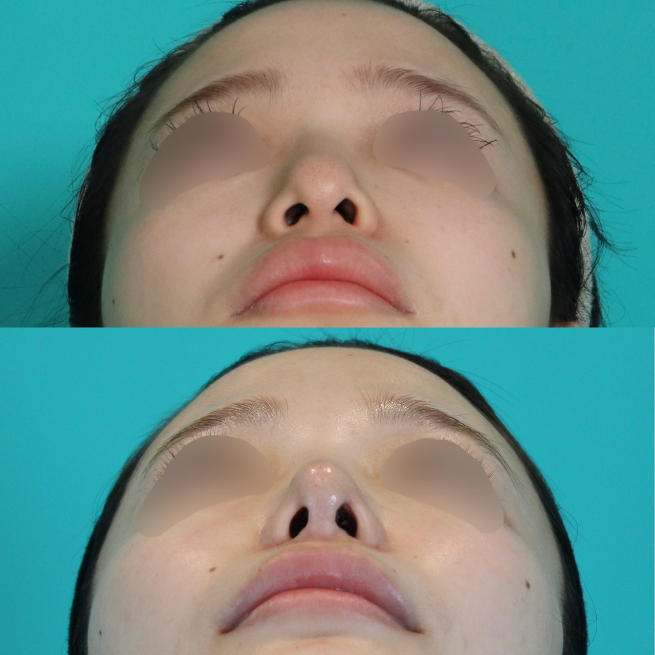 施術前後イメージ