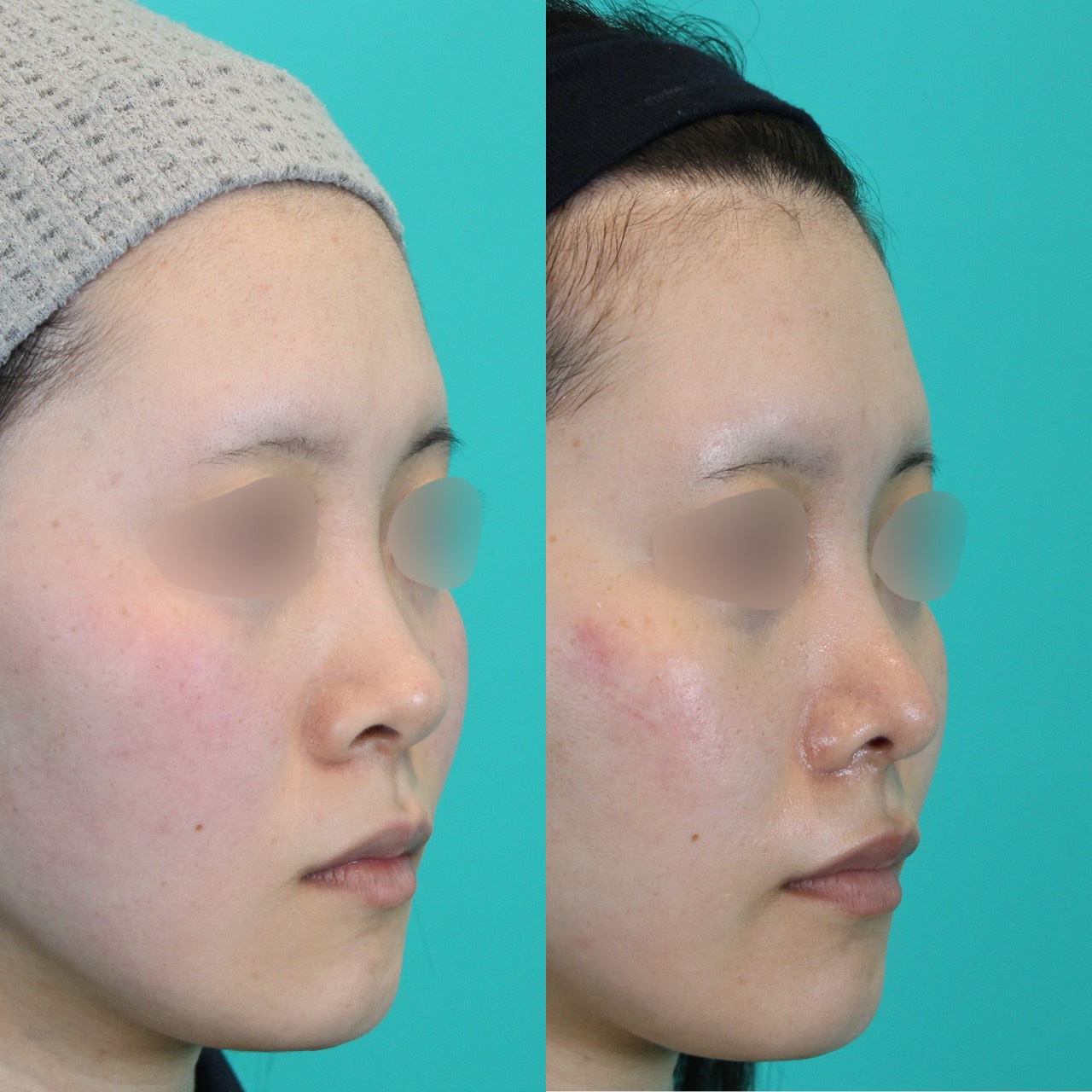 施術前後イメージ