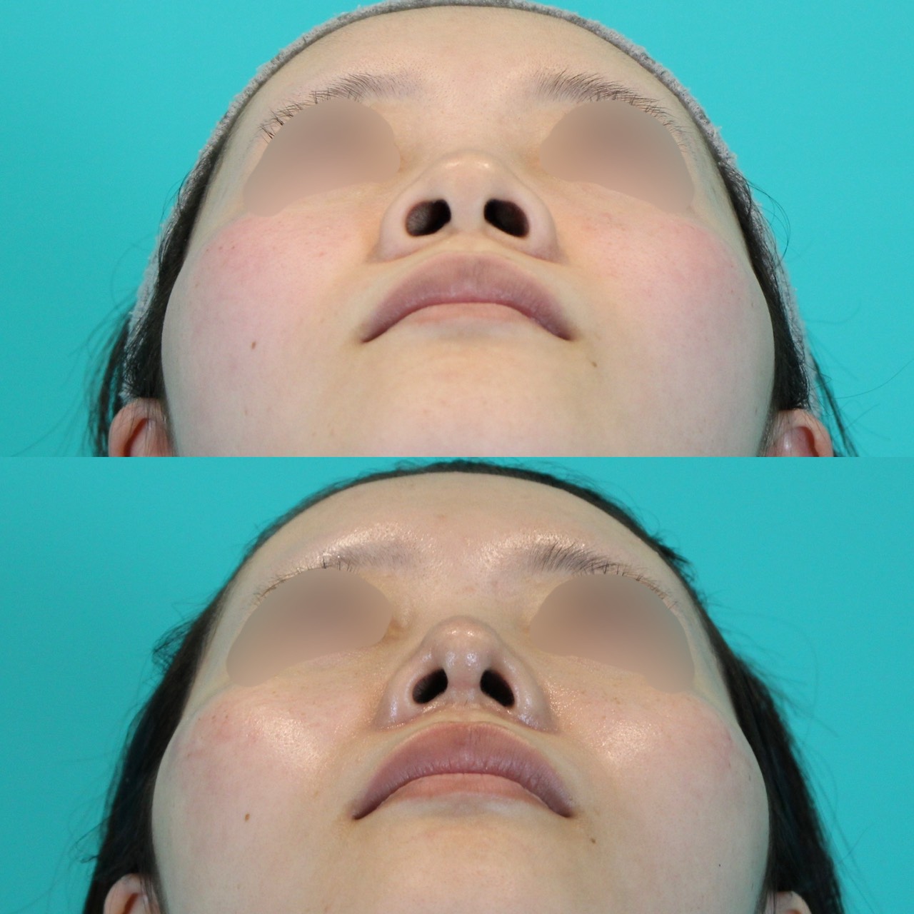 施術前後イメージ