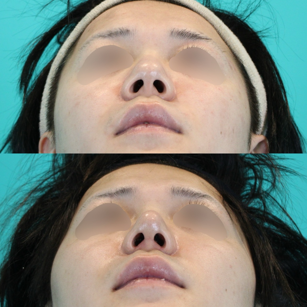 施術前後イメージ