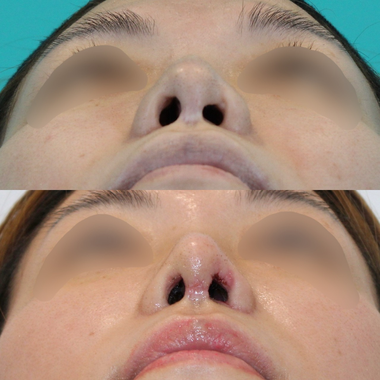 施術前後イメージ