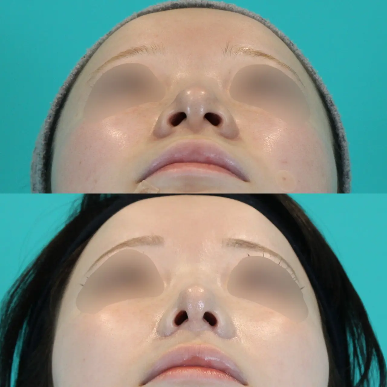 施術前後イメージ