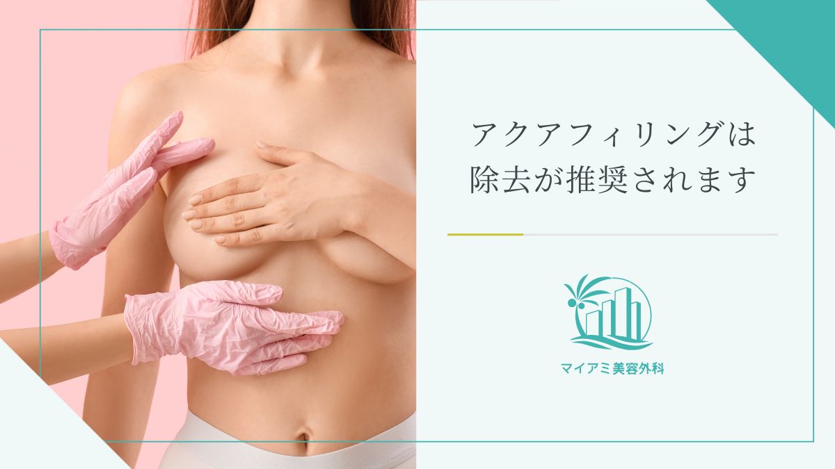 アクアフィリングは除去が推奨されます