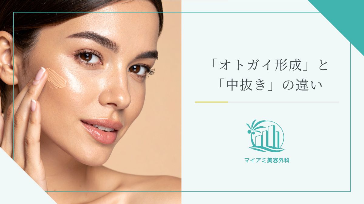 「オトガイ形成」と「中抜き」の違い