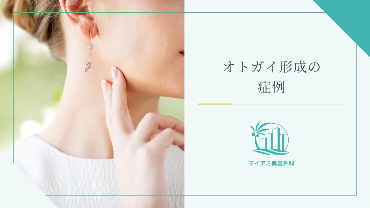 オトガイ形成の症例