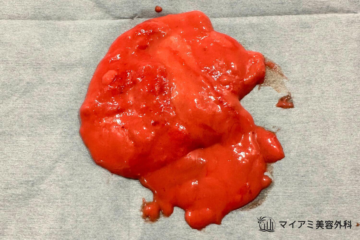 吸引除去直後のアクアフィリングの画像