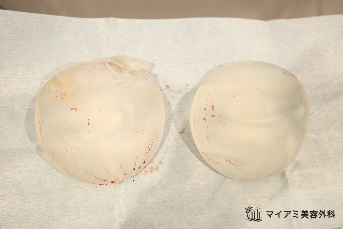 軽度破損したシリコンバッグ