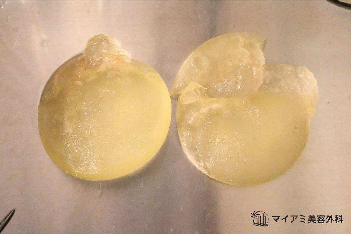 中程度破損のシリコンバッグ