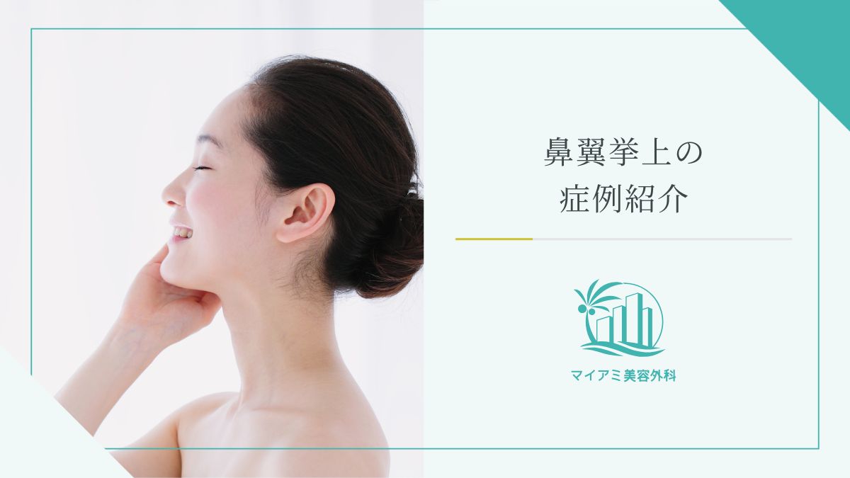 鼻翼挙上の症例紹介