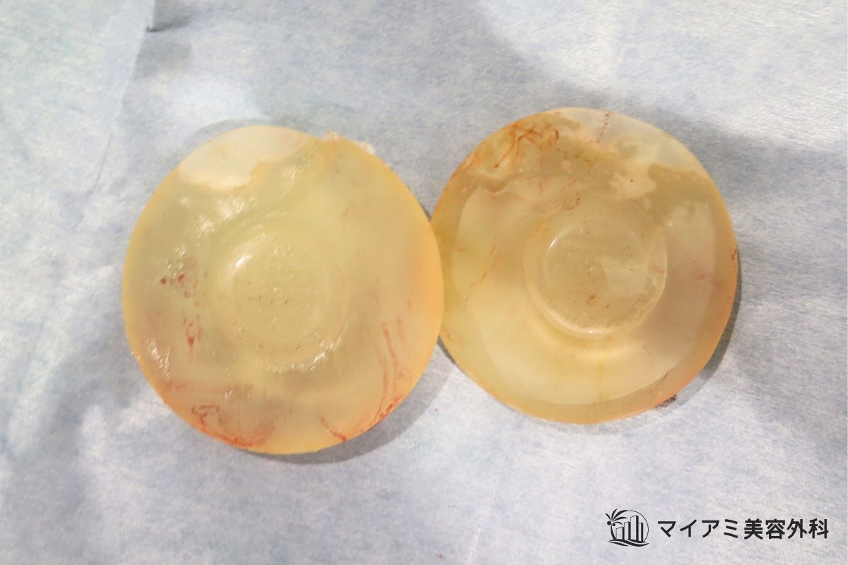 小さな穴が空いているシリコンバッグ