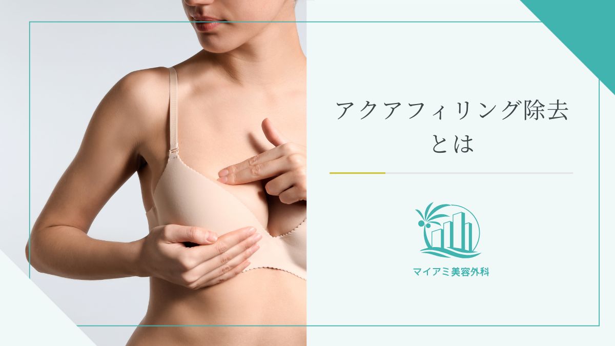 アクアフィリング除去とは