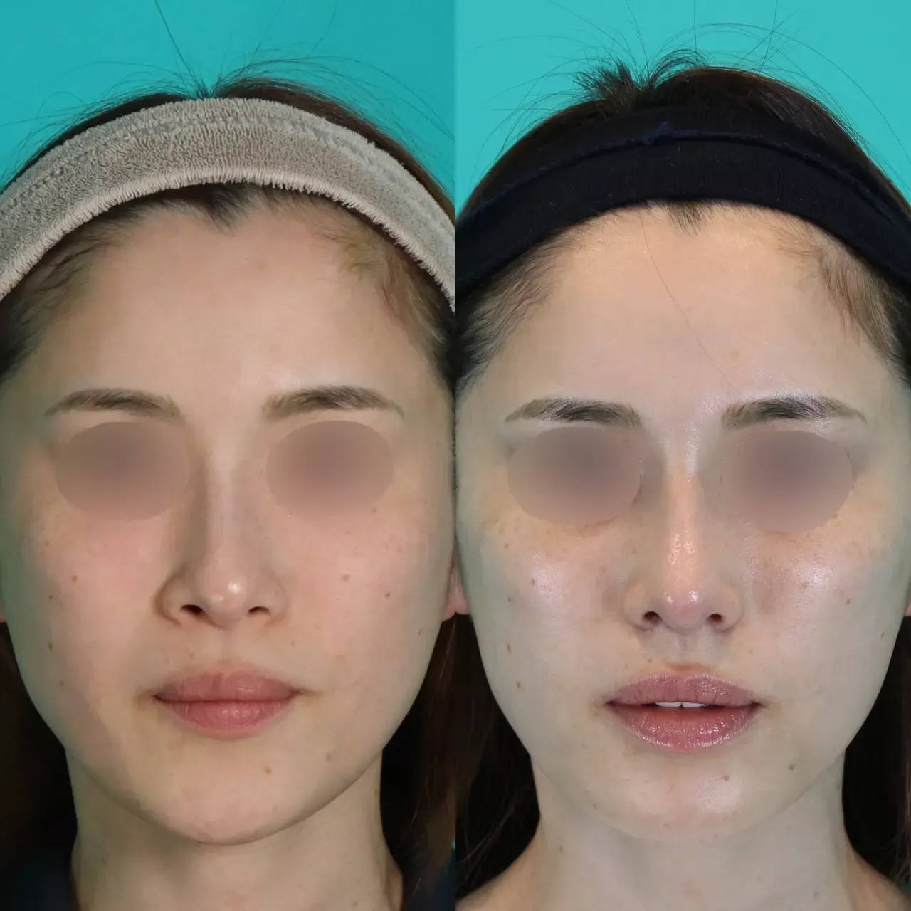 施術前後イメージ