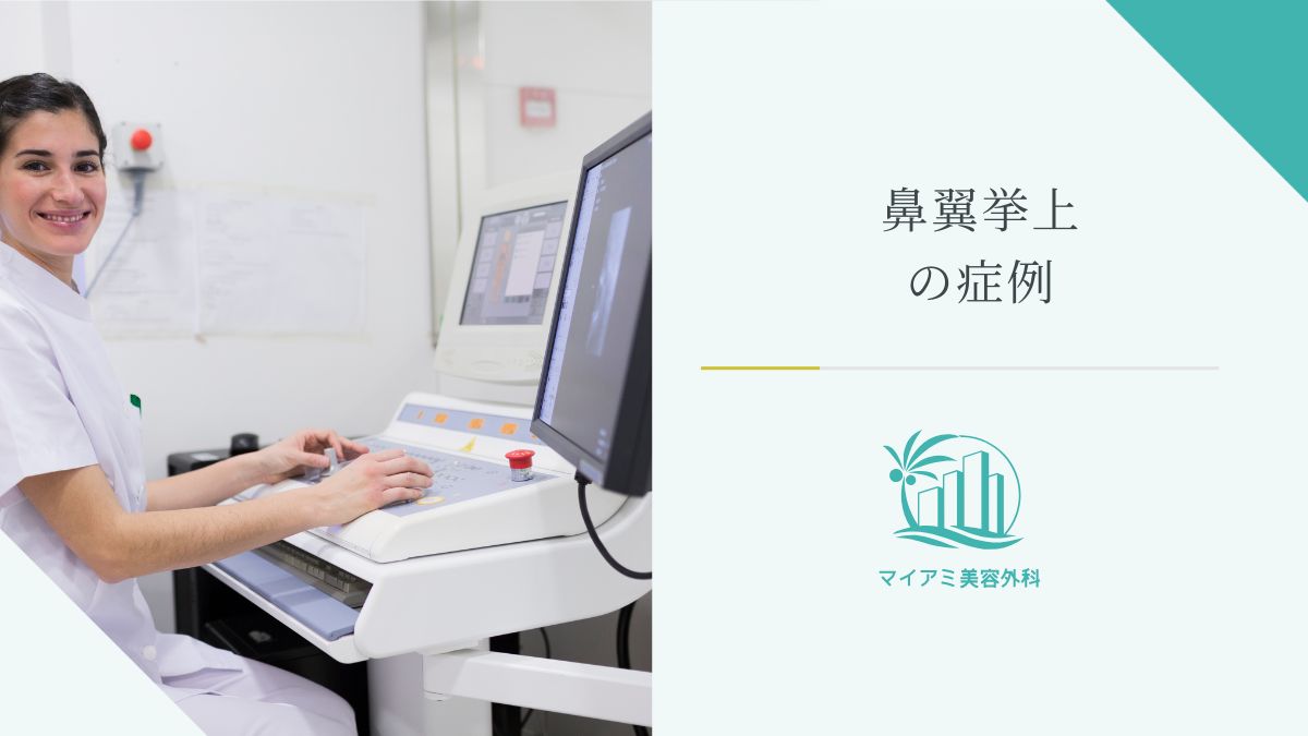 鼻翼挙上の症例