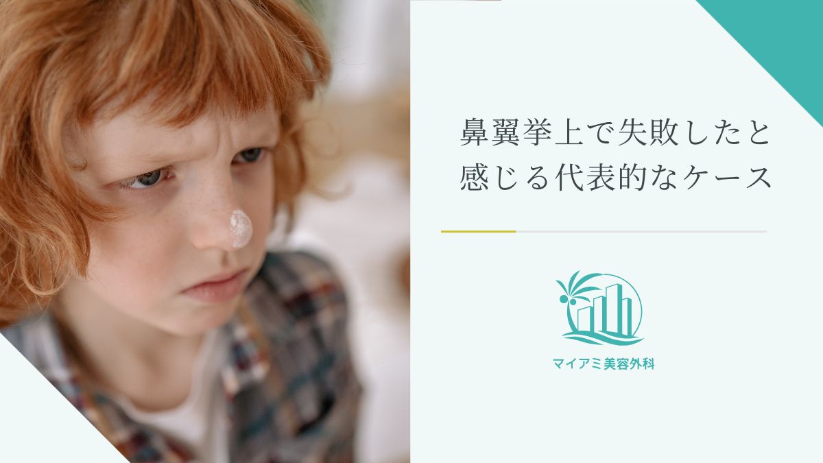 鼻翼挙上で失敗したと感じる代表的なケース