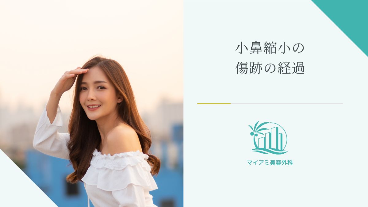 小鼻縮小の傷跡の経過