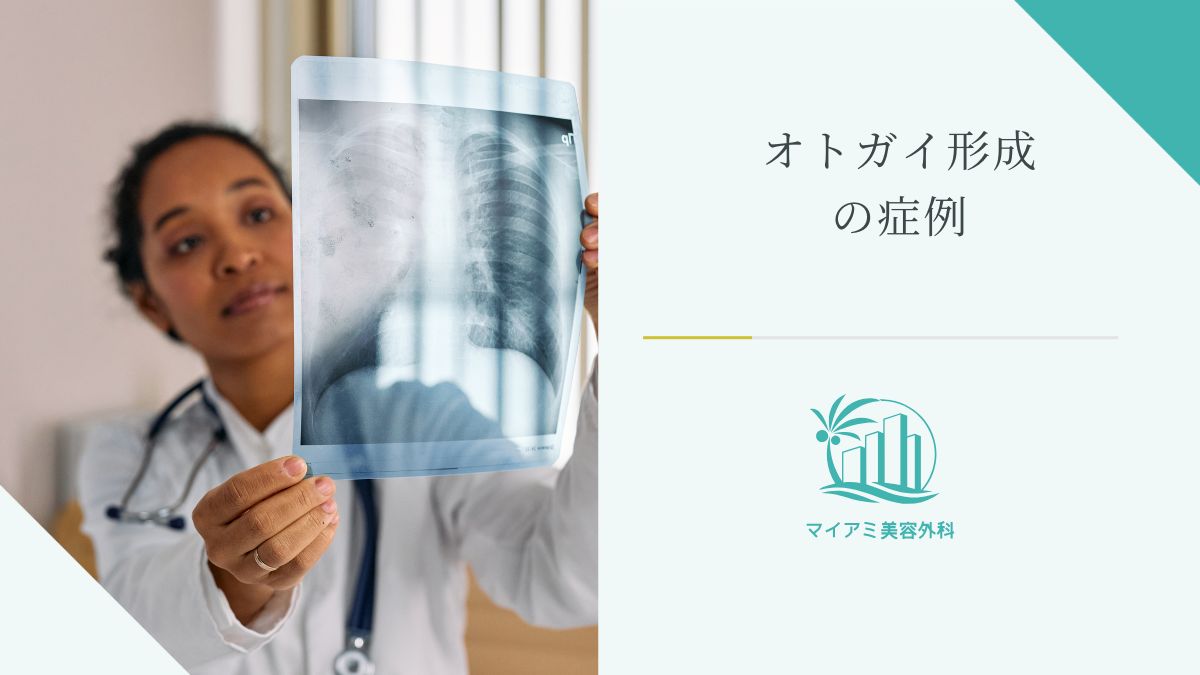 オトガイ形成の症例