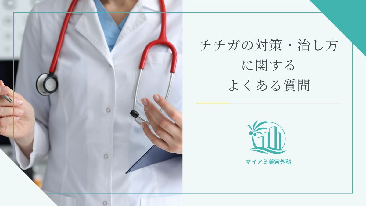 チチガに関するよくある質問