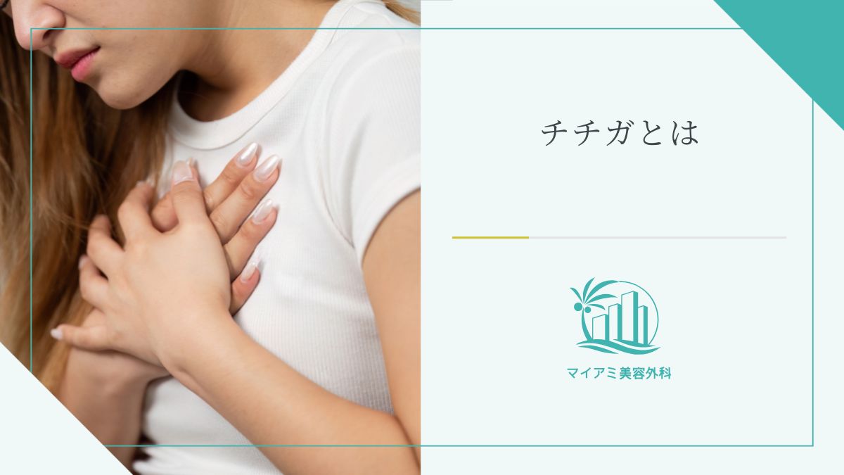 チチガとは