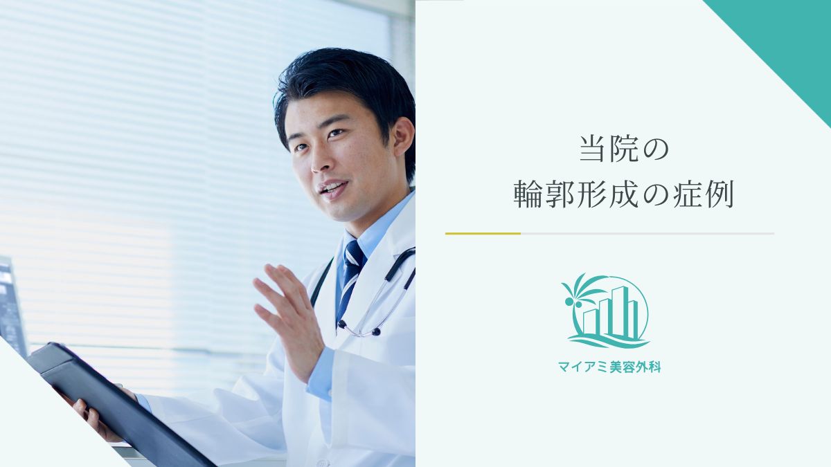 当院の輪郭形成の症例