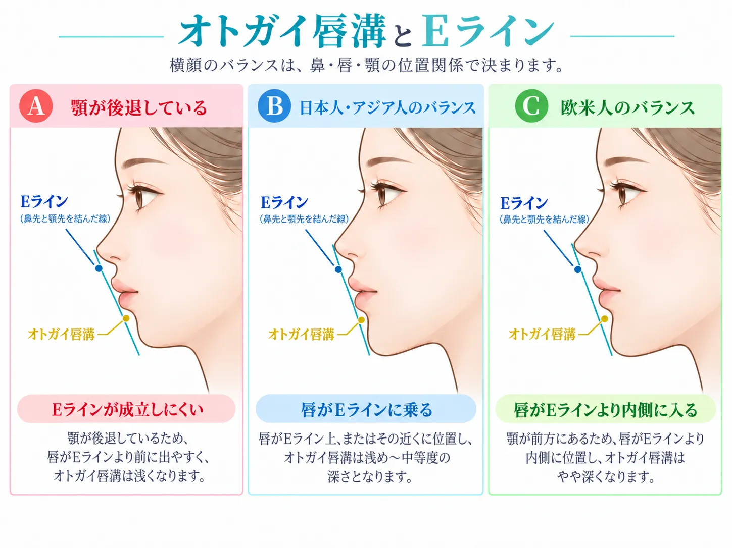 オトガイ唇溝とEライン